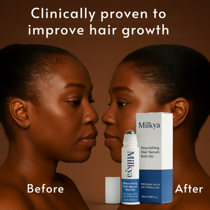 Milkya | Anti-Receding Hairline Roll-On