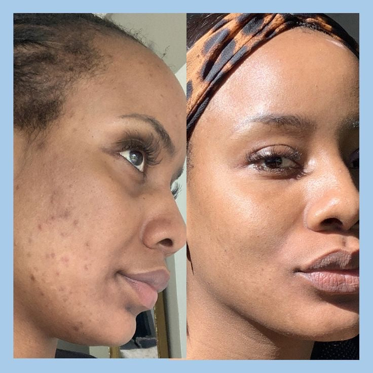 Milkya Dreamelon – Glow & Repair Blend