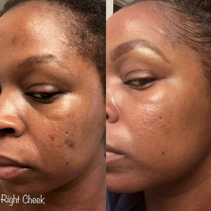 Milkya Glowberry – Radiant Skin