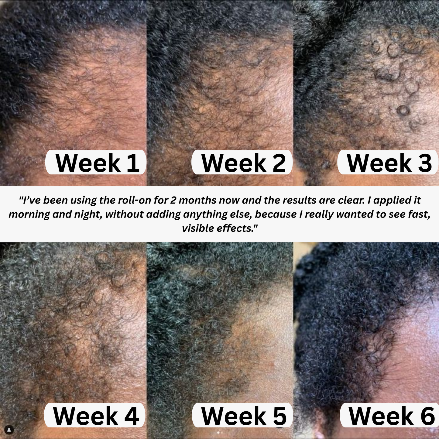 Milkya | Anti-Receding Hairline Roll-On